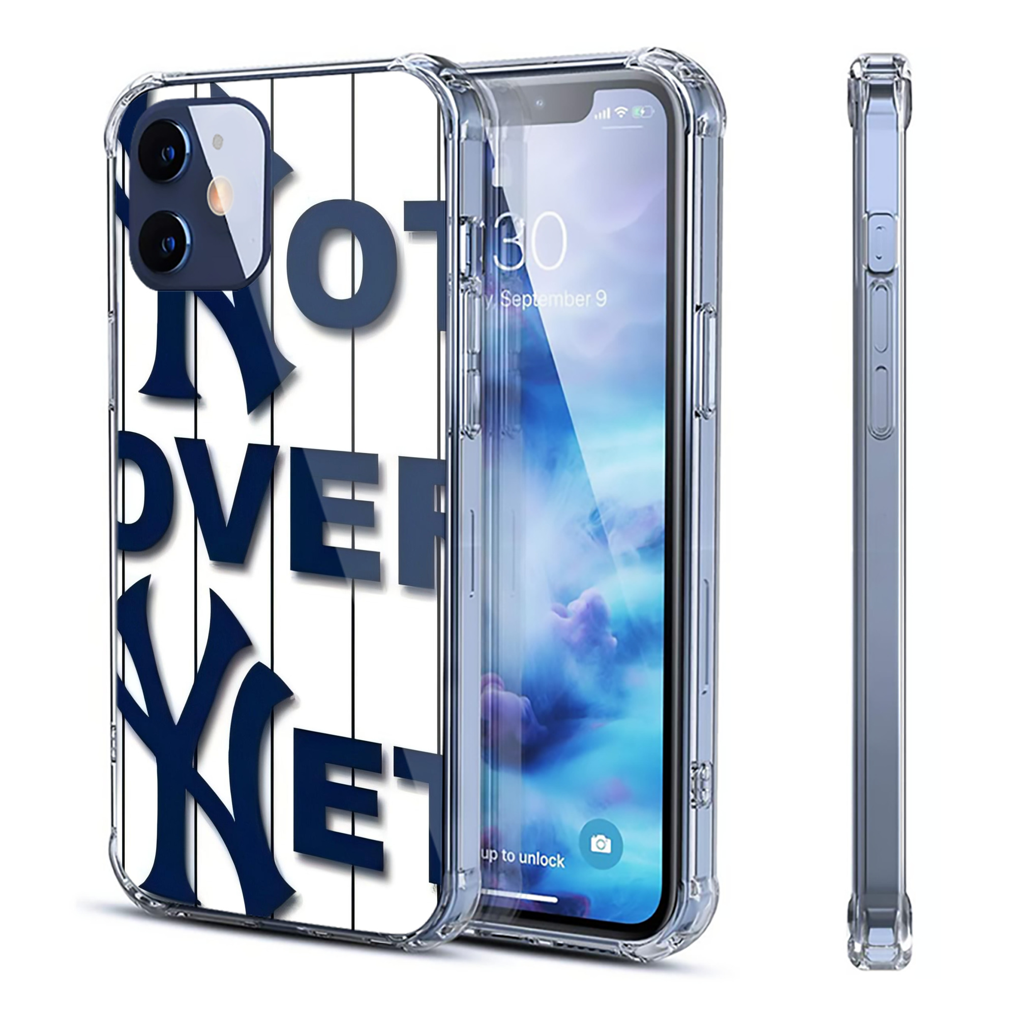 New York Yankees Not over Net Clear IPhone 12 Case – Soft TPU With UV Print – Enhanced Drop Protection, Precise Fit, Anti-Fingerprint, Customizable Design, Scratch-Resistant, Yellow-Resistant